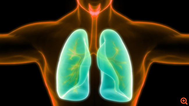 Καρκίνος του πνεύμονα: Τι αλλάζει στη θεραπεία