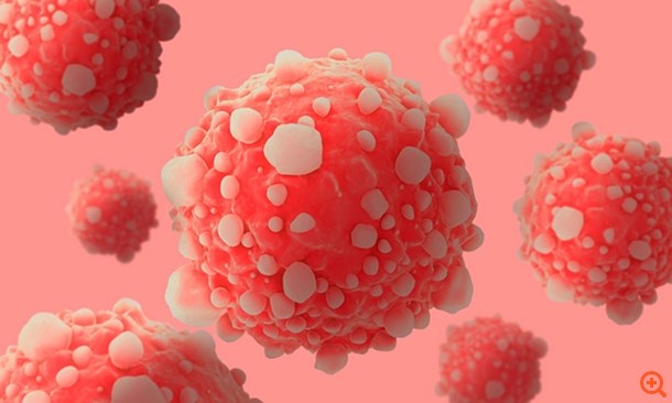 Αυξάνονται ανησυχητικά τα κρούσματα καρκίνου παγκοσμίως