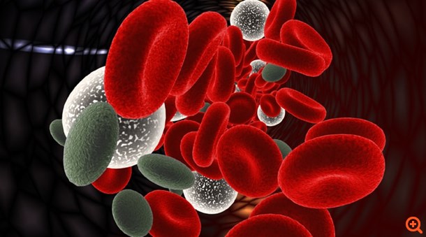 Πειραματικό τεστ DNA προβλέπει υποτροπές στον καρκίνο του εντέρου