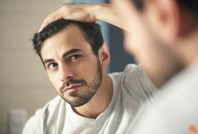 Μεταμόσχευση μαλλιών FUE: Πόσο διαρκεί το αποτέλεσμα;