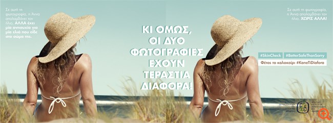 Πρόληψη για μελάνωμα: Φέτος το καλοκαίρι κάνε τη διαφορά!