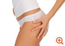 Τι σχέση έχει η κυτταρίτιδα με το μεταβολικό σύνδρομο;