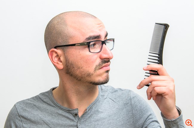 Η σύγχρονη εποχή στη μεταμόσχευση μαλλιών