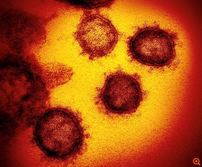 coronavirus3