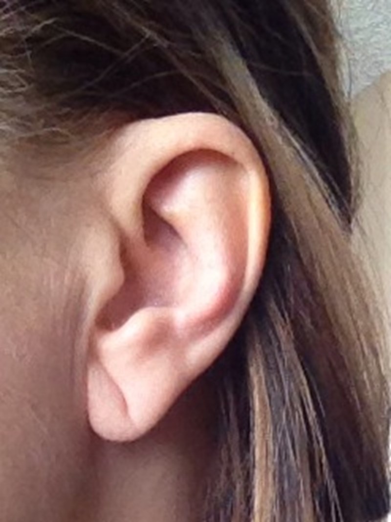 στεφανιαία 2/10/15