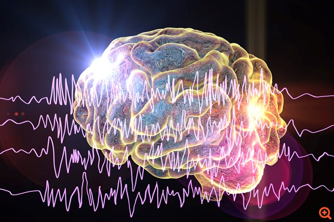 εγκέφαλος επιληψία 2021