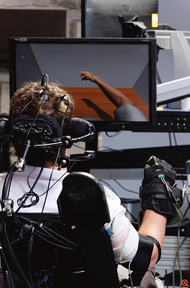 Το τσιπ εγκεφάλου ίσως δημιουργεί υπερβολικές ελπίδες