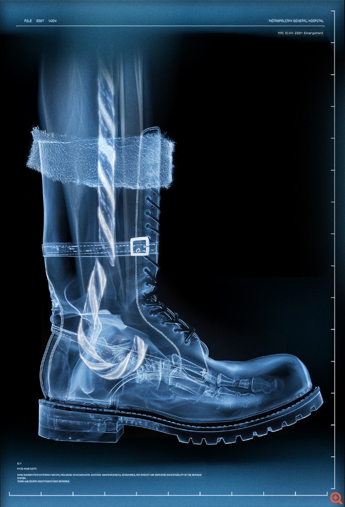 Έντονη ανησυχία στον Βόρειο Πόλο μετά τον τραυματισμό του Αϊ Βασίλη στο μπάσκετ