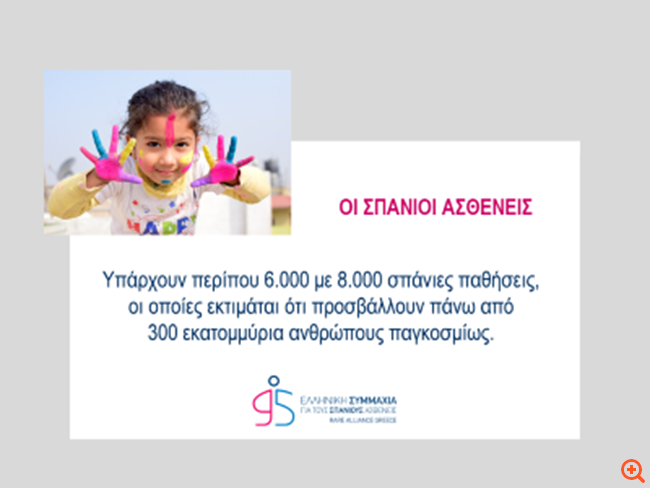 Σπάνιες παθήσεις για... 300 εκατομμύρια ανθρώπους