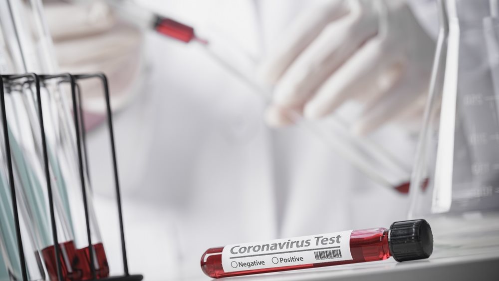 Κορονοϊός: 391 νέα κρούσματα και 1 θάνατος - Στους 98 οι διασωληνωμένοι