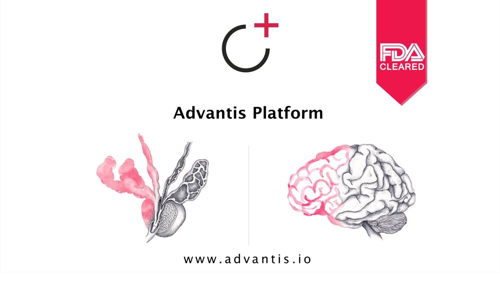 Advantis Medical Imaging Focus στις ΗΠΑ για την ελληνική startup
