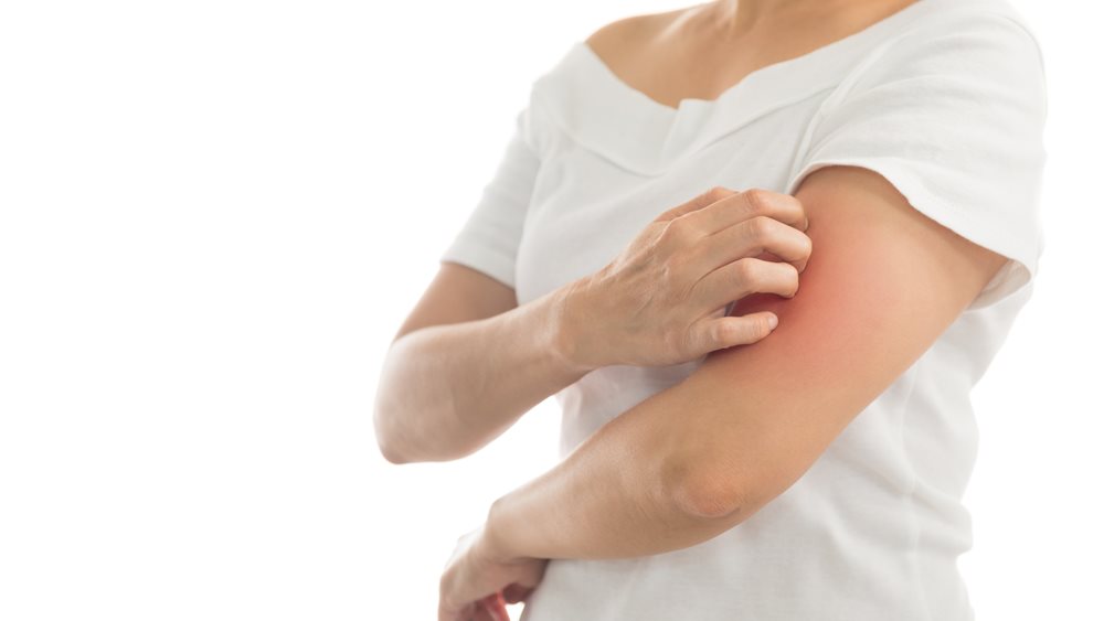 Ψωρίαση: Νέες θεραπείες αλλάζουν τη ζωή των ασθενών