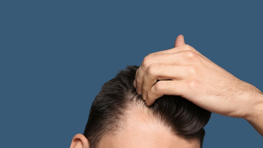 Γιατί δεν αρκούν οι βιταμίνες για την αντιμετώπιση της τριχόπτωσης;