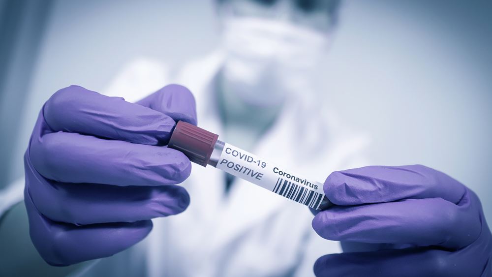 Πάνω από 18.000 μοριακοί έλεγχοι στα αεροδρόμια Νοτίου Αιγαίου