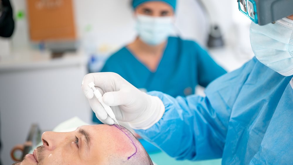 Seneca Medical Group: Η ηγέτιδα δύναμη στη μεταμόσχευση μαλλιών