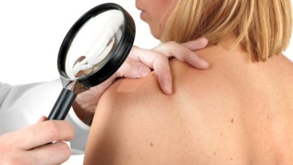 Πρώτη φορά στην Ελλάδα εμβόλιο mRNA κατά του δερματικού μελανώματος