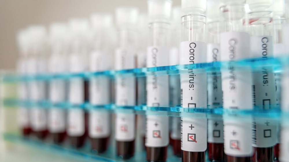 Κορονοϊός: 407 ημερήσια κρούσματα, 4 νέοι θάνατοι - Σε &quot;καραντίνα&quot; Ιωάννινα και Κοζάνη