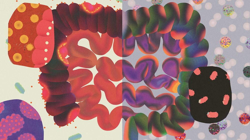 COVID: Σαφέστερη εικόνα των μακροχρόνιων επιπτώσεων