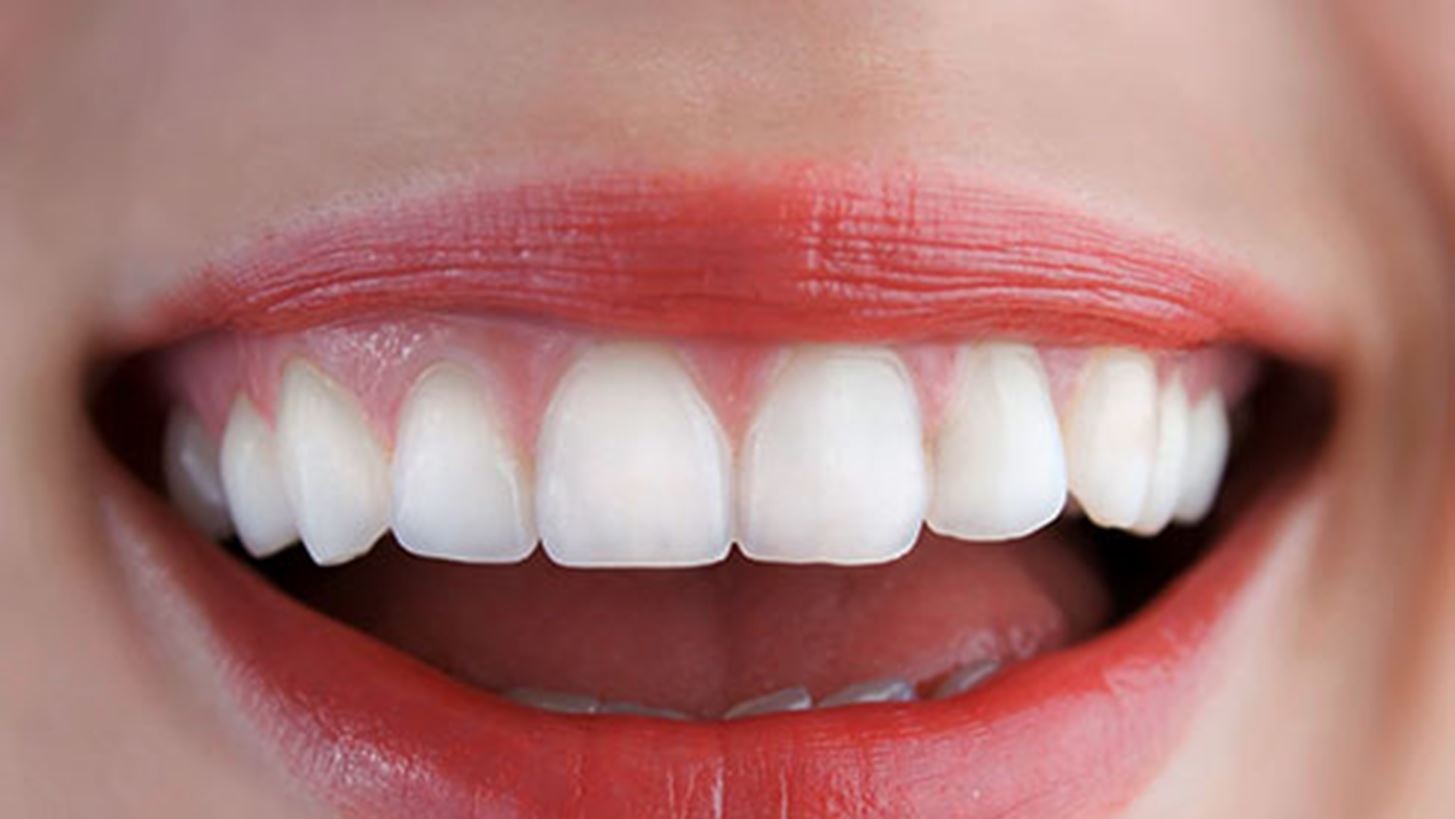 Λευκότερα δόντια με τη βοήθεια της κοσμητικής