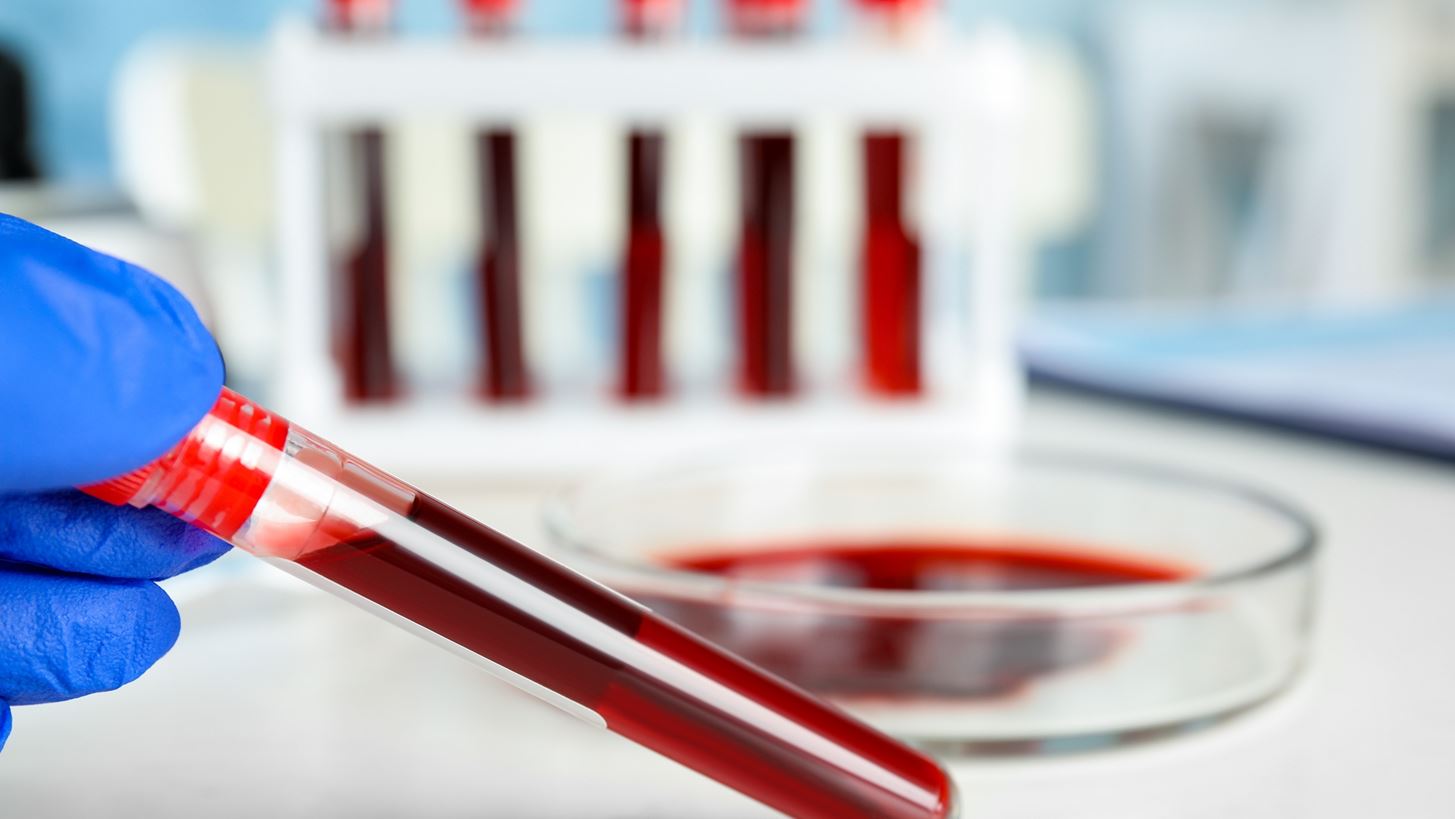 Πώς ανεβαίνει ο χαμηλός αιματοκρίτης;