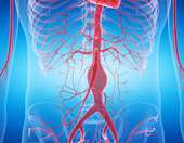 Ανεύρυσμα κοιλιακής αορτής: Τα συμπτώματα και η πρόληψη