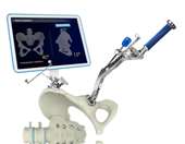 Νεότερες εξελίξεις στην αντιμετώπιση της οστεοαρθρίτιδας ισχίου