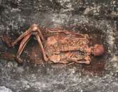 Αρχαίοι σκελετοί "ρίχνουν φως" σε σύγχρονα ιατρικά μυστήρια