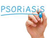 Η πρώτη πανελλήνια πολυκεντρική μελέτη για την απρεμιλάστη στην μέτρια ψωρίαση