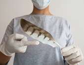 Θεσσαλονίκη: Επιβεβαιώθηκε κρούσμα του ιού της γρίπης των πτηνών στη λίμνη Κερκίνη