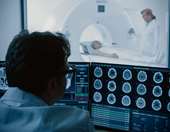 Ποιοι τύποι καρκίνου αυξάνονται ραγδαία και εμφανίζονται όλο και συχνότερα σε άτομα κάτω των 50 ετών