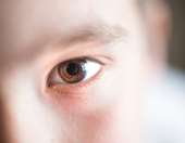 Νέα θεραπεία δίνει ελπίδες για παιδιά με διαταραχή της όρασης λόγω σπάνιας ασθένειας