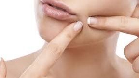 10 πράγματα που δεν πρέπει να κάνετε αν έχετε σπυράκια