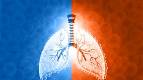 Κυστική ίνωση: Υπογραφή συμφωνίας αποζημίωσης για τις καινοτόμες θεραπείες στην Ελλάδα