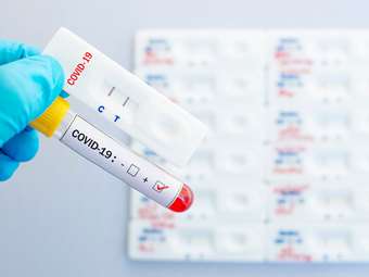 ΕΟΔΥ: Συνεχίζει να αυξάνεται η θετικότητα για Covid-19