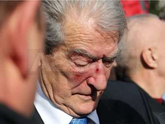 Αλβανία: Ο πρώην πρόεδρος και πρωθυπουργός Μπερίσα τέθηκε υπό κράτηση κατ' οίκον στο πλαίσιο έρευνας για διαφθορά