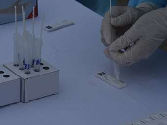 ΕΟΔΥ: Ανιχνεύθηκε και στην Ελλάδα η υπό παρακολούθηση υποπαραλλαγή XEC του Covid-19