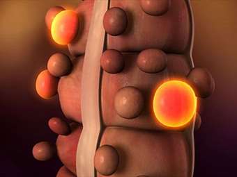 Τεστ αίματος θα μπορεί να ανιχνεύει τον καρκίνο του παχέος εντέρου