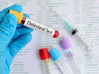 Παίρνετε στατίνες για τη χοληστερίνη; Νέα έρευνα λέει πως ίσως δεν χρειάζεται