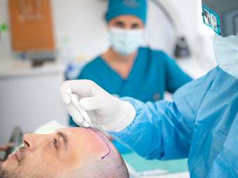 Seneca Medical Group: Η ηγέτιδα δύναμη στη μεταμόσχευση μαλλιών