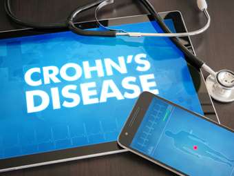 Για πρώτη φορά στην Ελλάδα στο Αρεταίειο λειτουργεί Πολυδύναμο Διεπιστημονικό Ιατρείο Ιδιοπαθών Φλεγμονωδών Νοσημάτων του Εντέρου