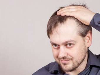 TRICOPAT: Νέα θεραπεία τριχόπτωσης με θεαματικά αποτελέσματα