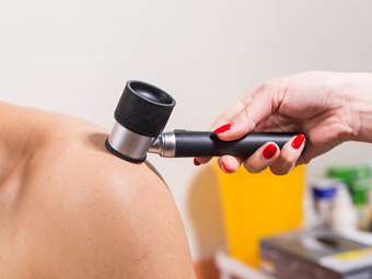 Καρκίνος του δέρματος: Τι είναι το βασικοκυτταρικό καρκίνωμα που εμφάνισε ο γνωστός σεφ Γκόρντον Ράμσεϊ