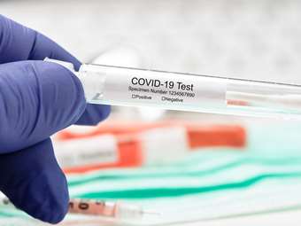 ΕΟΔΥ: 3 θάνατοι από Covid-19, 8 διασωληνωμένοι, 153 εισαγωγές