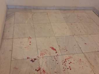 Επίθεση κουκουλοφόρων σε εκδήλωση στη Νομική - Στο νοσοκομείο με σοβαρά τραύματα μεταπτυχιακός φοιτητής