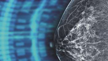 Τεχνητή νοημοσύνη και πρόληψη: Τι περιμένουμε