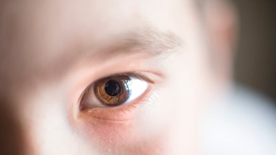 Νέα θεραπεία δίνει ελπίδες για παιδιά με διαταραχή της όρασης λόγω σπάνιας ασθένειας